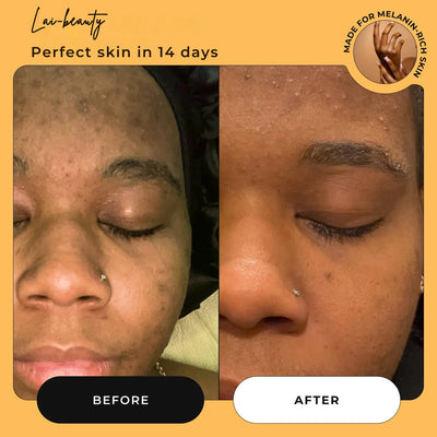Lai™ Turmeric Soap