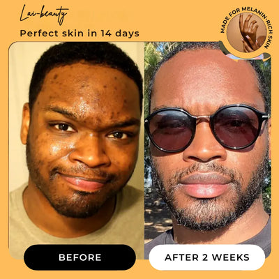 Lai™ Turmeric Soap