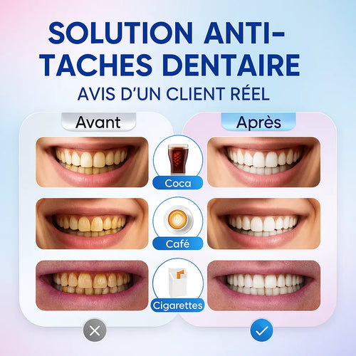 Dentifrice blanchissant