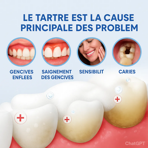 Dentifrice blanchissant