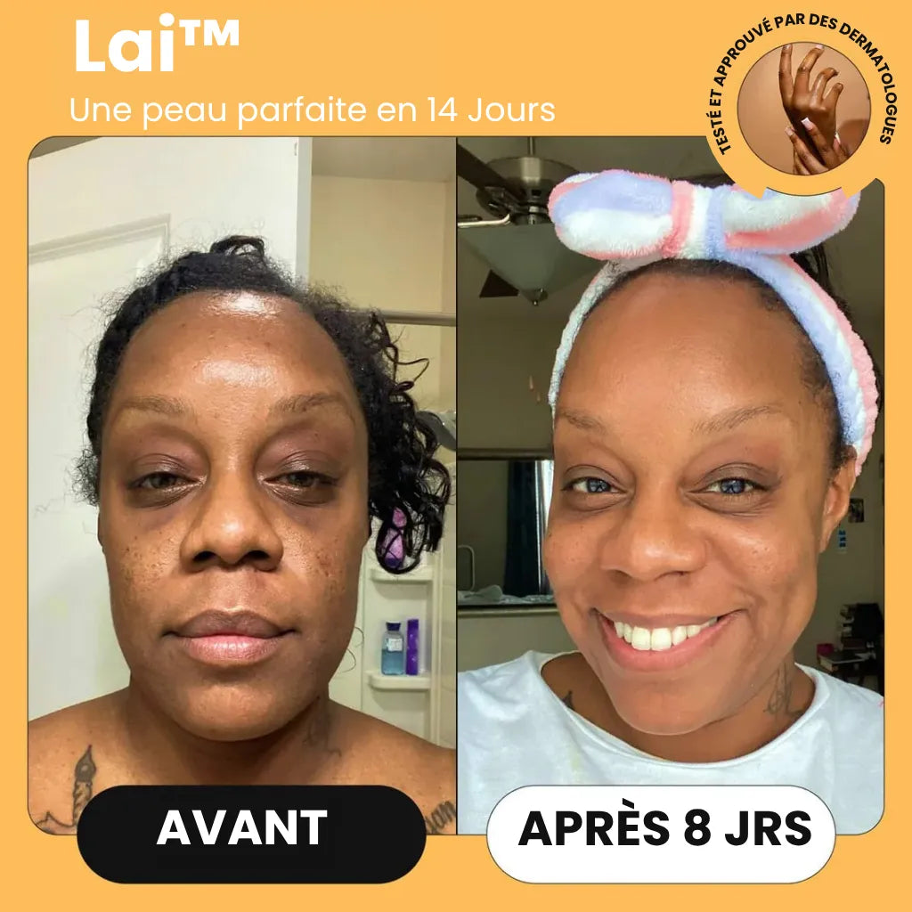 Savon au Curcuma Lai™