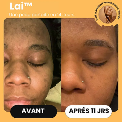 Savon au Curcuma Lai™