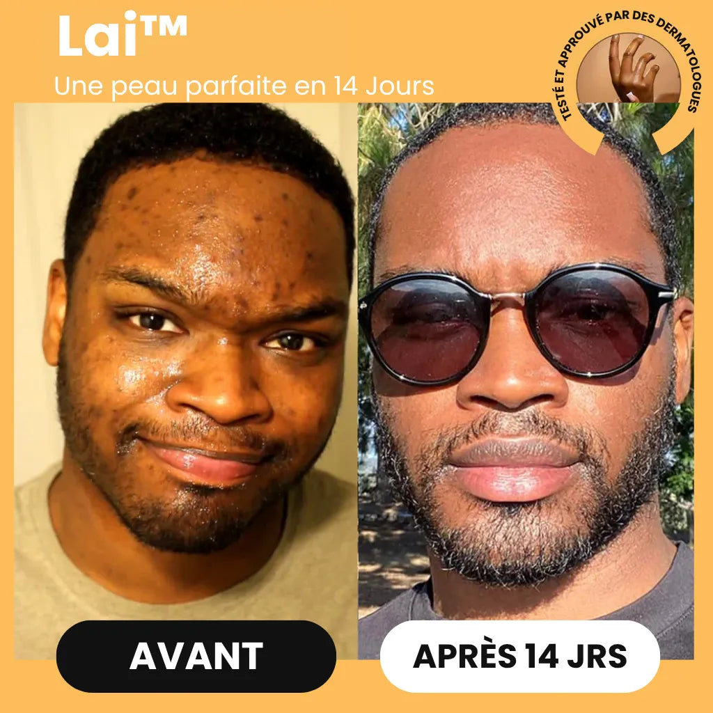 Savon au Curcuma Lai™